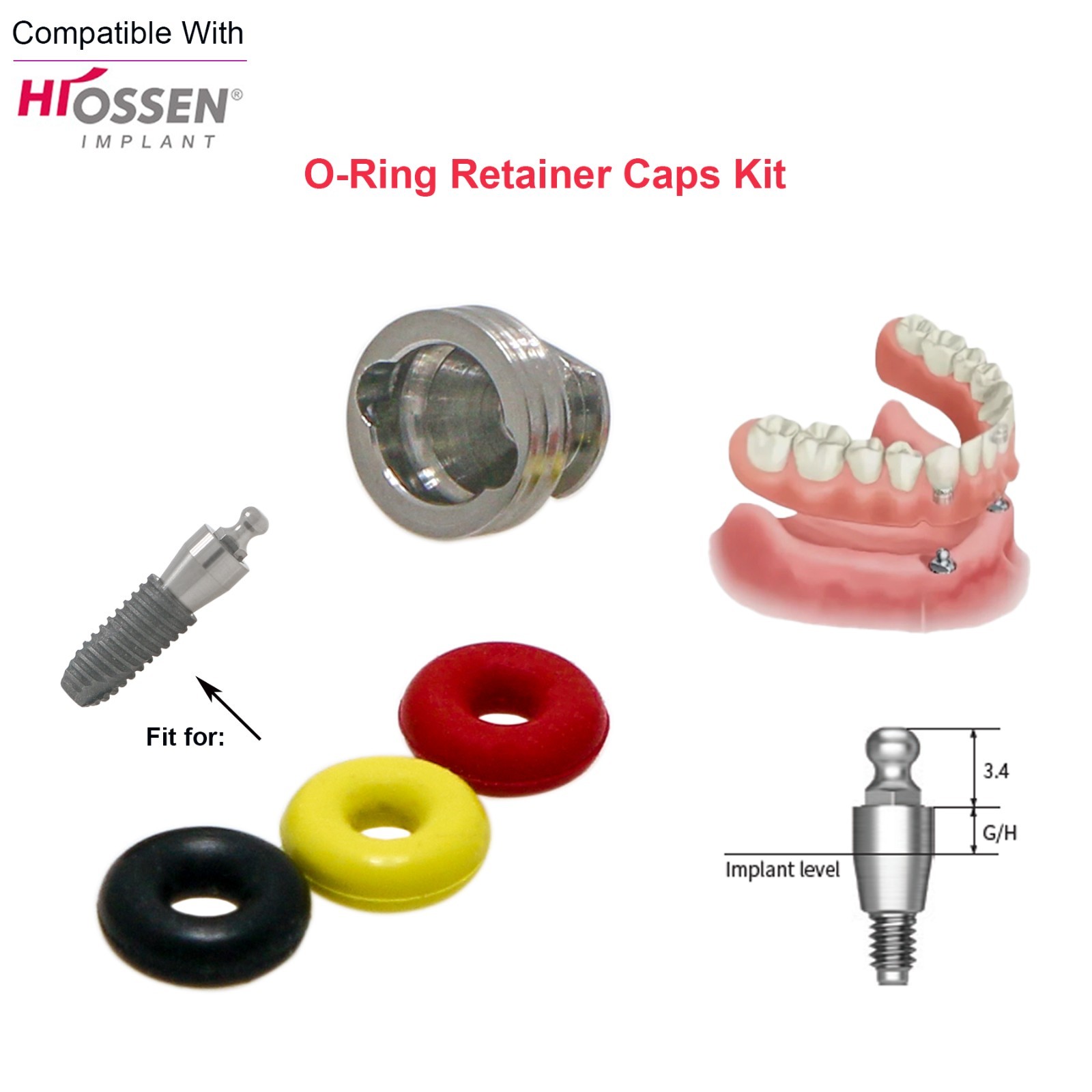 Dental Implant O-ring Retention Cap Kit For Hiossen/Osstem Ball Abutment 4pc/set