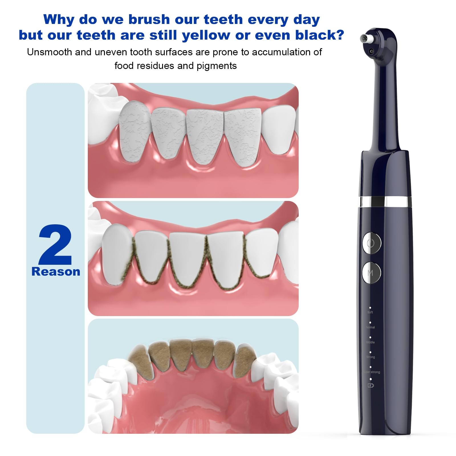 Tooth Polisher,Teeth Polishing Kit for Daily Cleaning,Polishing Then Whitening