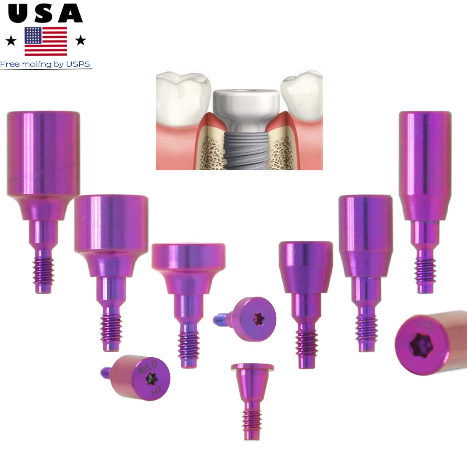 US Dental Healing Abutment NP RP ∅3.6/5.0/6.0 for Nobel Active Conical Titanium