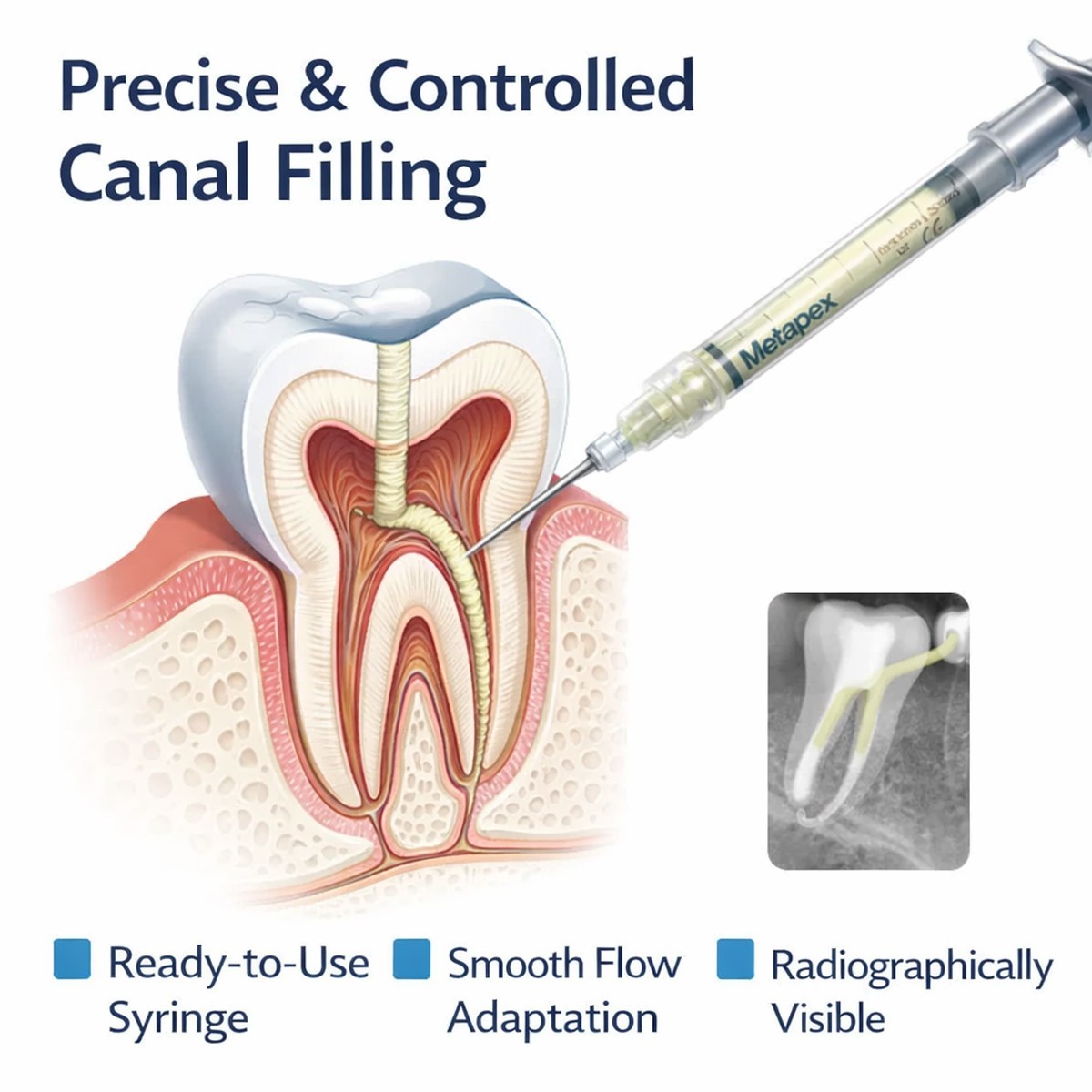 META Dental METAPEX Calcium Hydroside Temporary RCT Filling Material 2.2g Syr