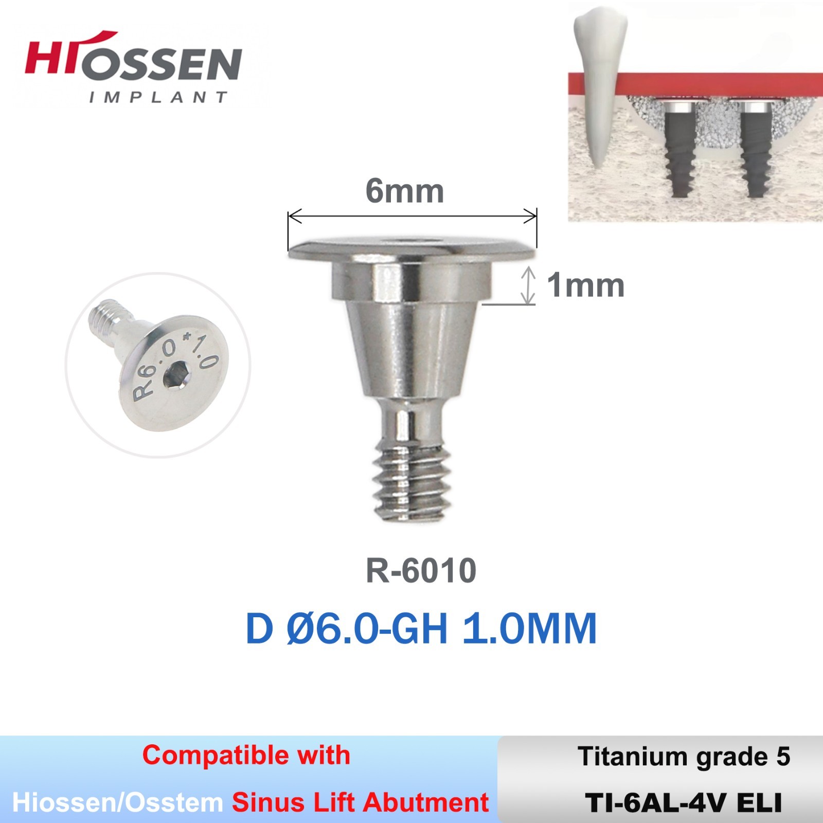 Ti Implant Sinus Lift Temporary Abutments Superline fit Hiossen / DIO UFI/II R