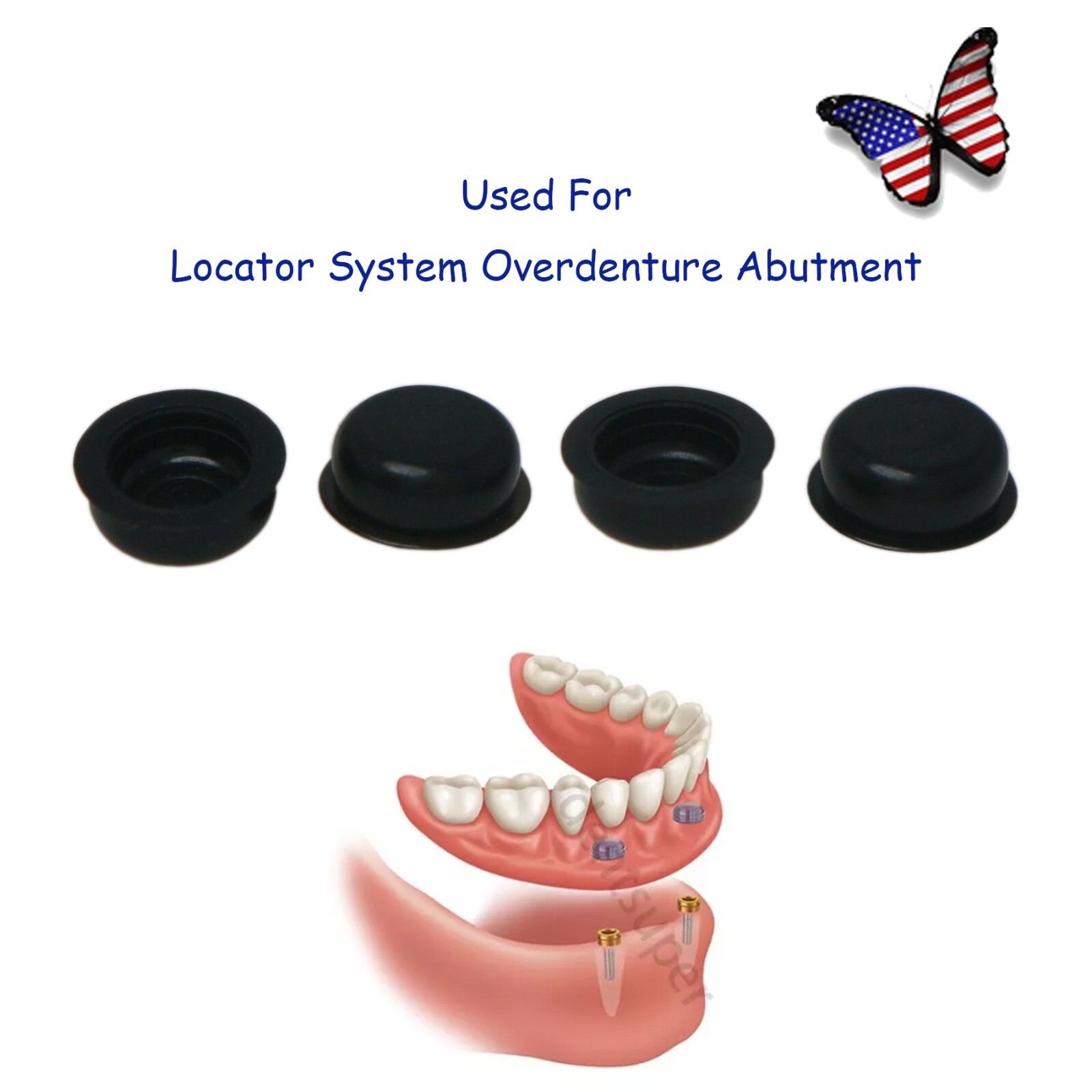 US Implant Overdenture Male Cap Insertion Fit Locator 1.2/2.4lbs Extraction Tool