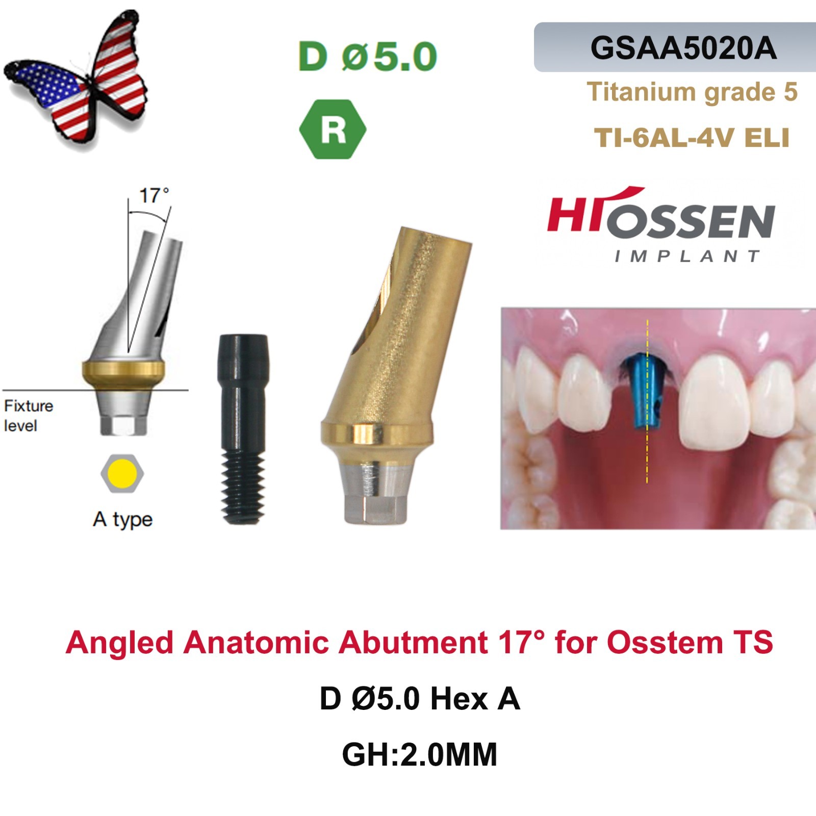 US Dental 17° Angled Abutment For Hiossen ET III Osstem TS Mini Regular Platform
