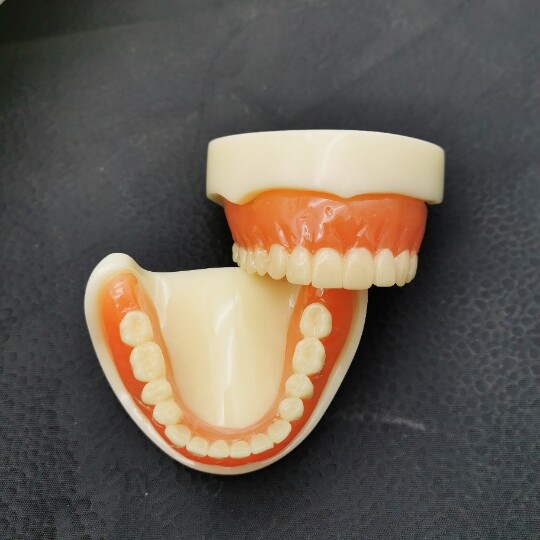 Dental 4 Implants Overdenture Typodont Restoration Upper Lower Lower Teeth Model