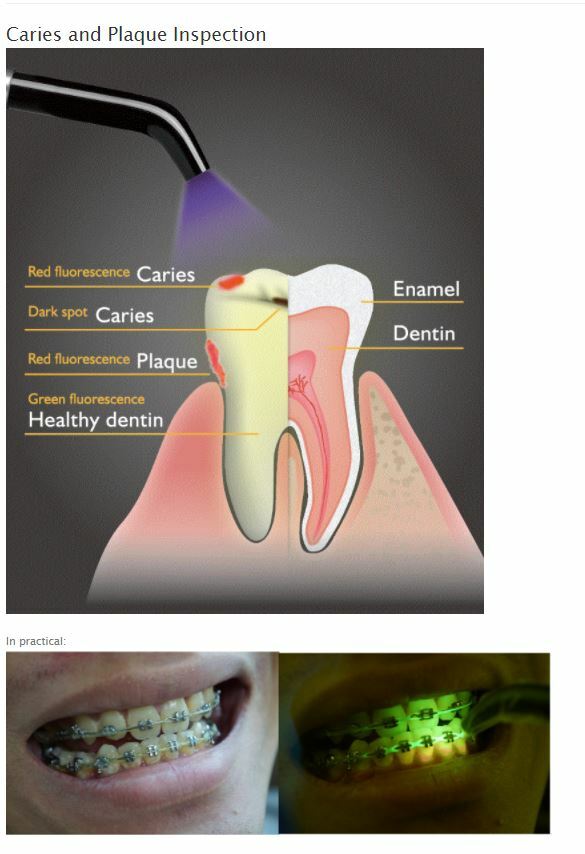DENTMATE Ledex WL-090+ Dental LED Curing Light Fast Cure with Caries Detector