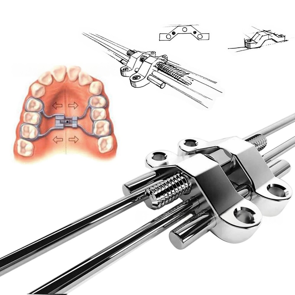 MSE Dental Orthodontic Mid Facial Rapid Palatal Expander Mandrel Expansion Screw