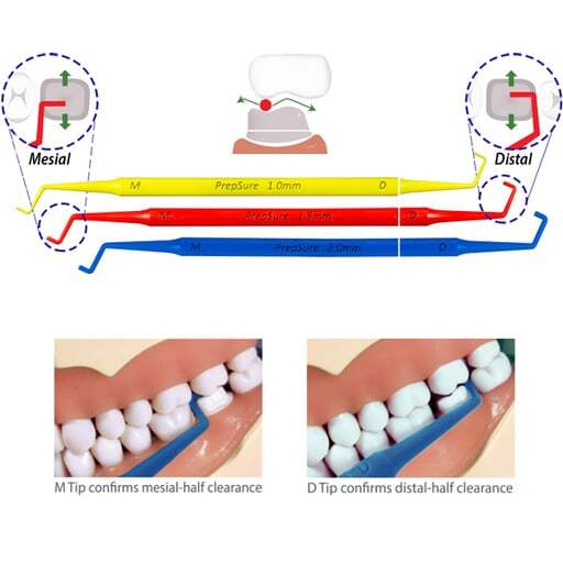 Directa ContacEZ PrepSure Classic Colors Crown Prep Guide Assorted Sizes 3/Pk
