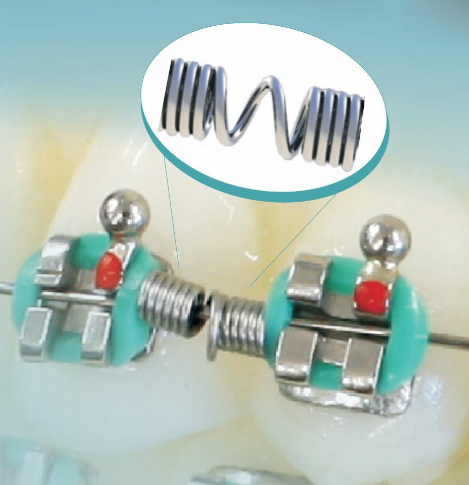 Dental Orthodontic Niti Open Closed Distalizion Coil Spring .010X.040 178mm150gf
