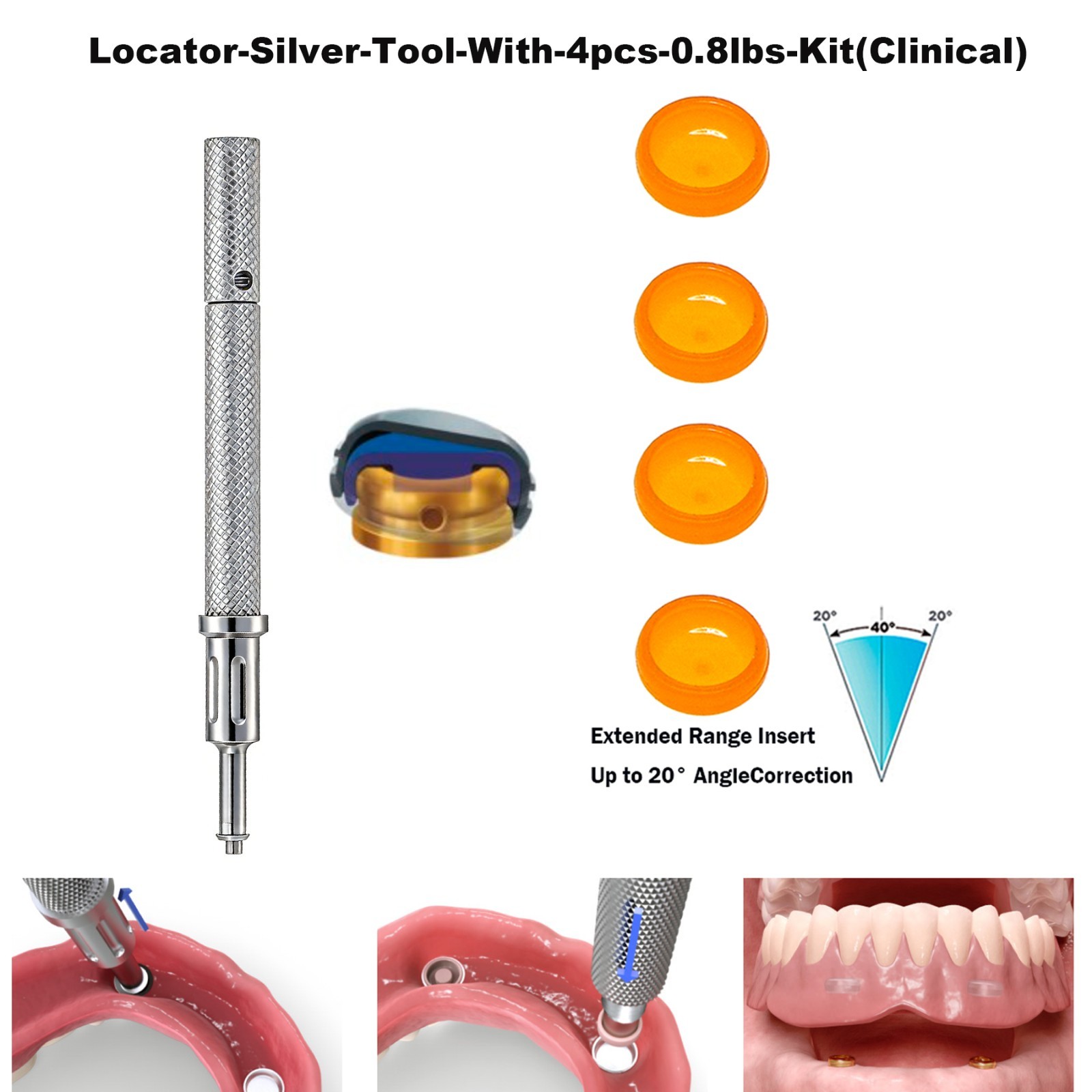 US Universal ZEST Locator PEEK Retention Cap Insertion Lab Core Extraction Tool