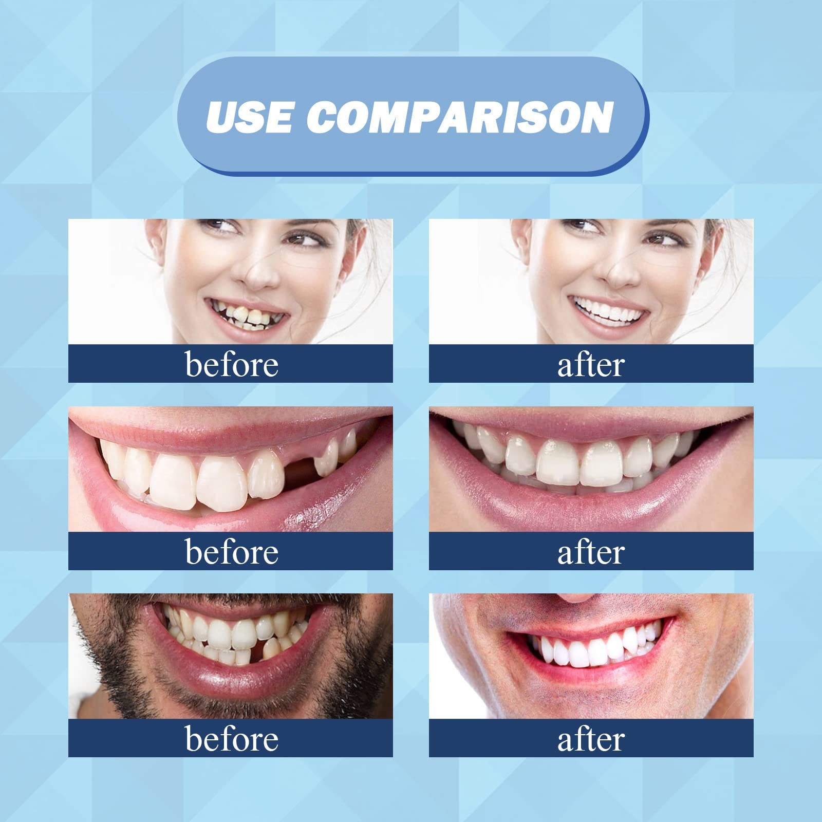 56 Pieces False Teeth, 2 Sets Whole Teeth Synthetic Polymer Denture Teeth,…