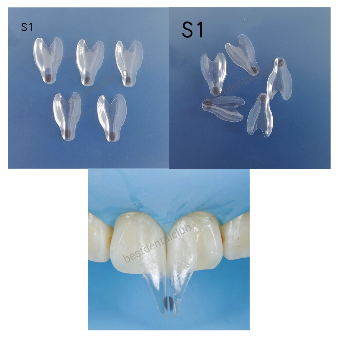Dental Widening Front Tranparent Clear Matrix BT Matrices Fits BioClear S1