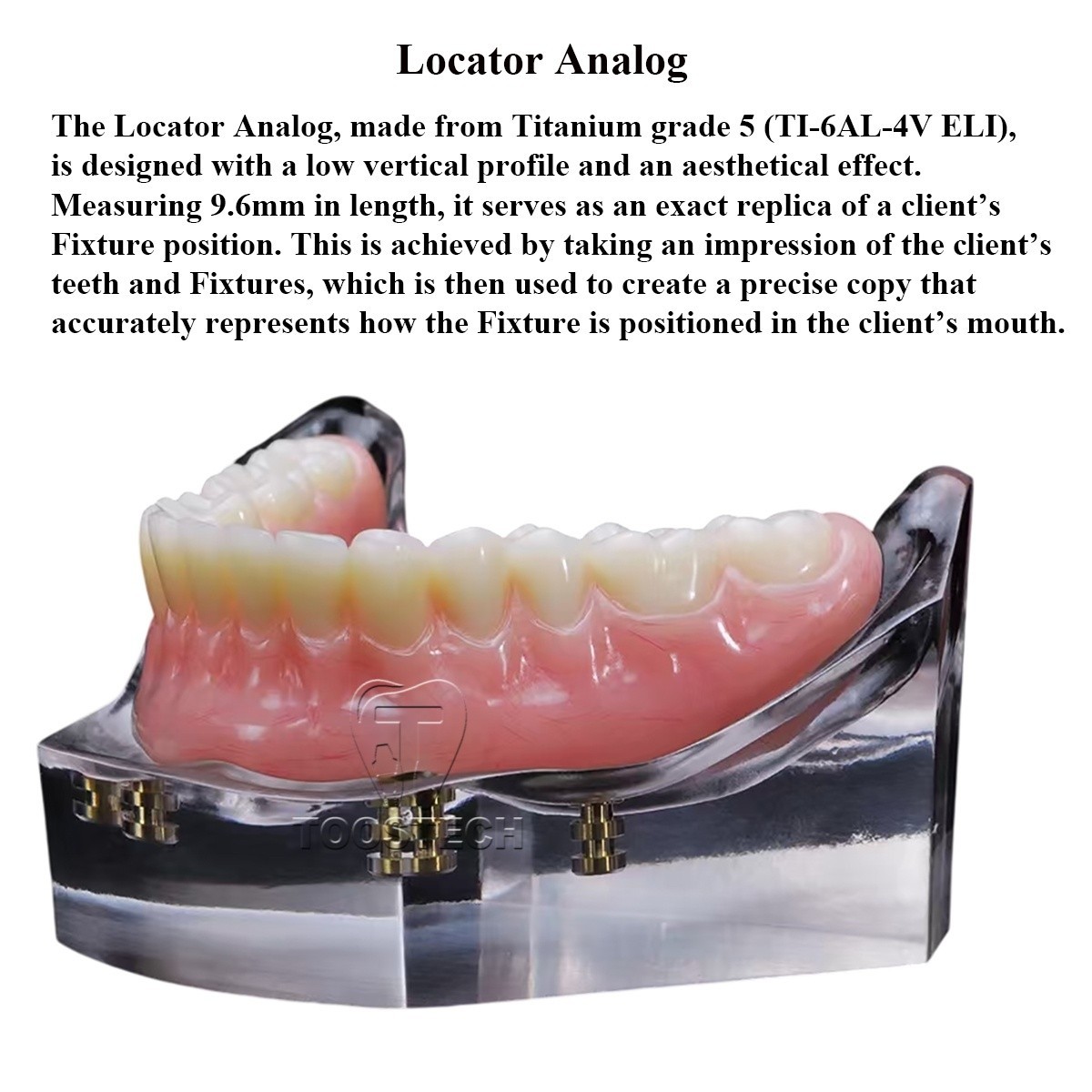 locator abutment set overdenture attachment kit fits to implant Direct Legacy