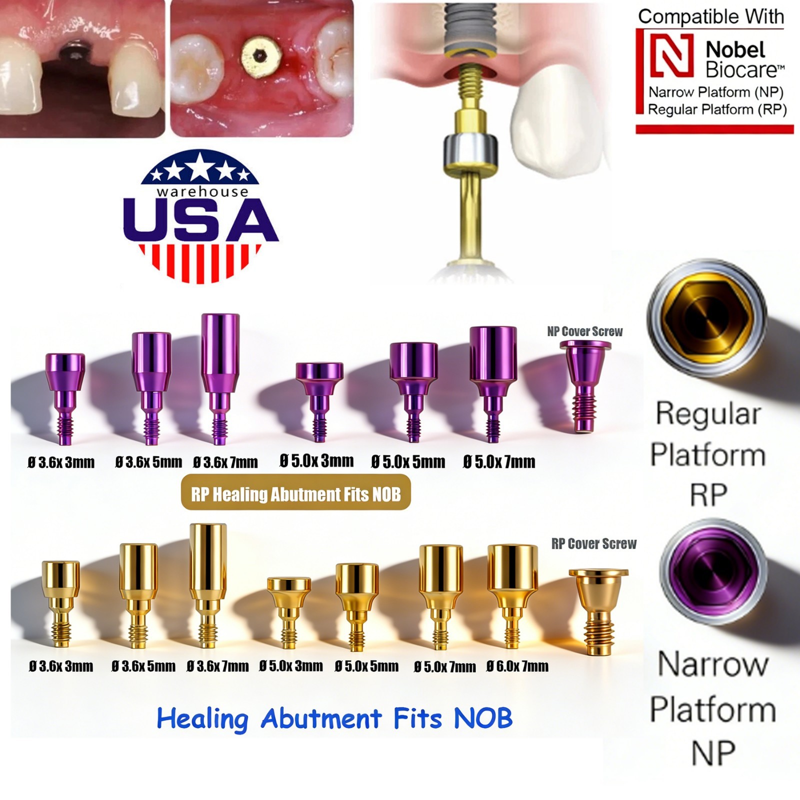 US 5Pc Dental Healing Abutment NP/RP Fit Nobel Biocare Internal Conical Titanium