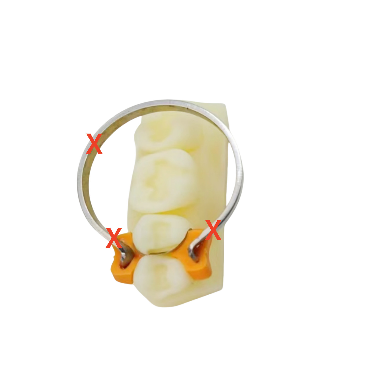 3Pieces Dental Healing Cap Abutment NP 3.6 H3 H5 H7 Compatible Nobel Active ∅3.6