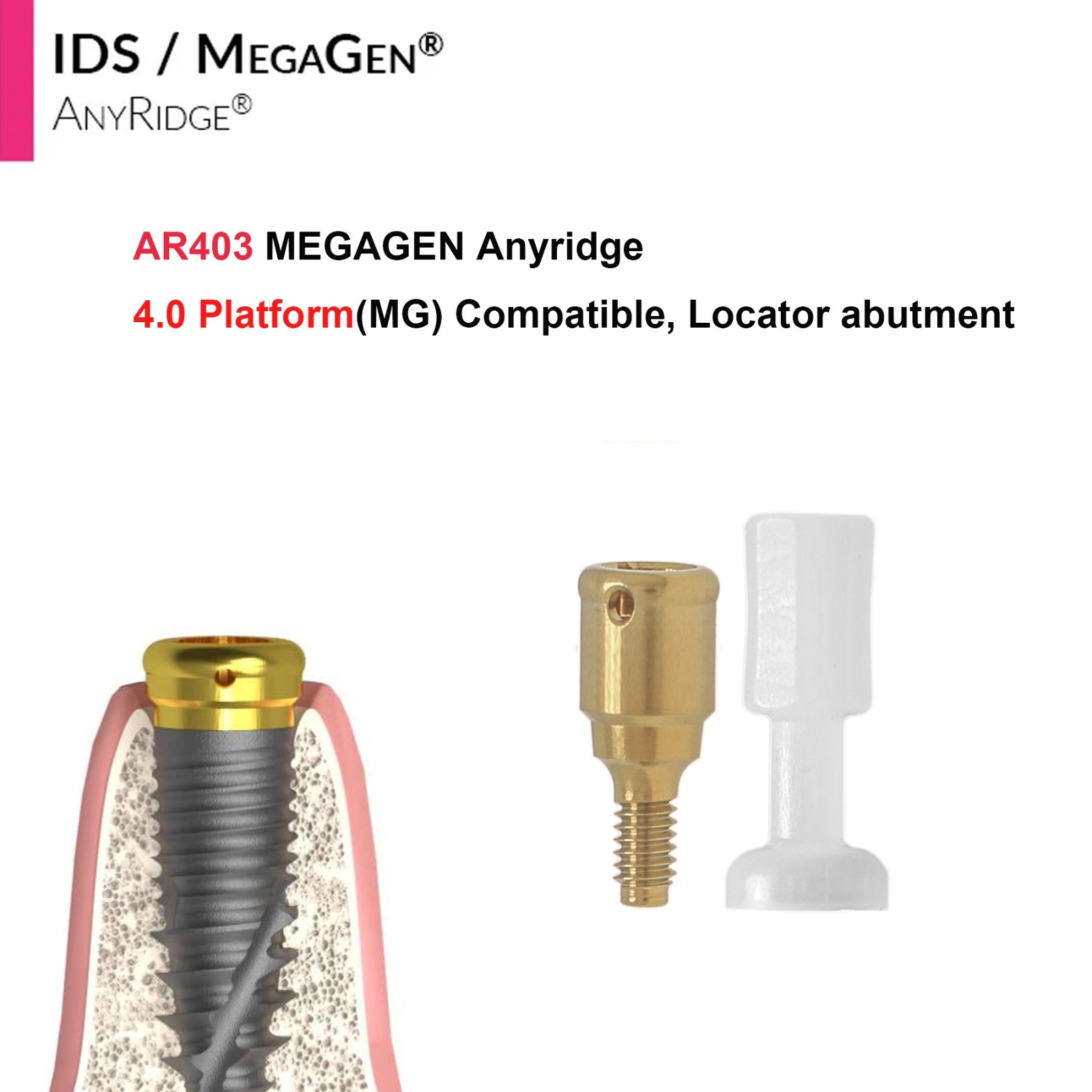 Dental Overdenture Locator Abutment Anchor for MEGAGEN AnyRidge 4.0 Platform Cap