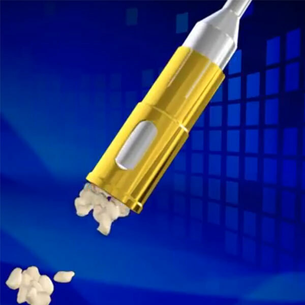 DSI NLBC Dental Implant Surgical Bone Graft Harvest Collector Augmentation 9Pcs