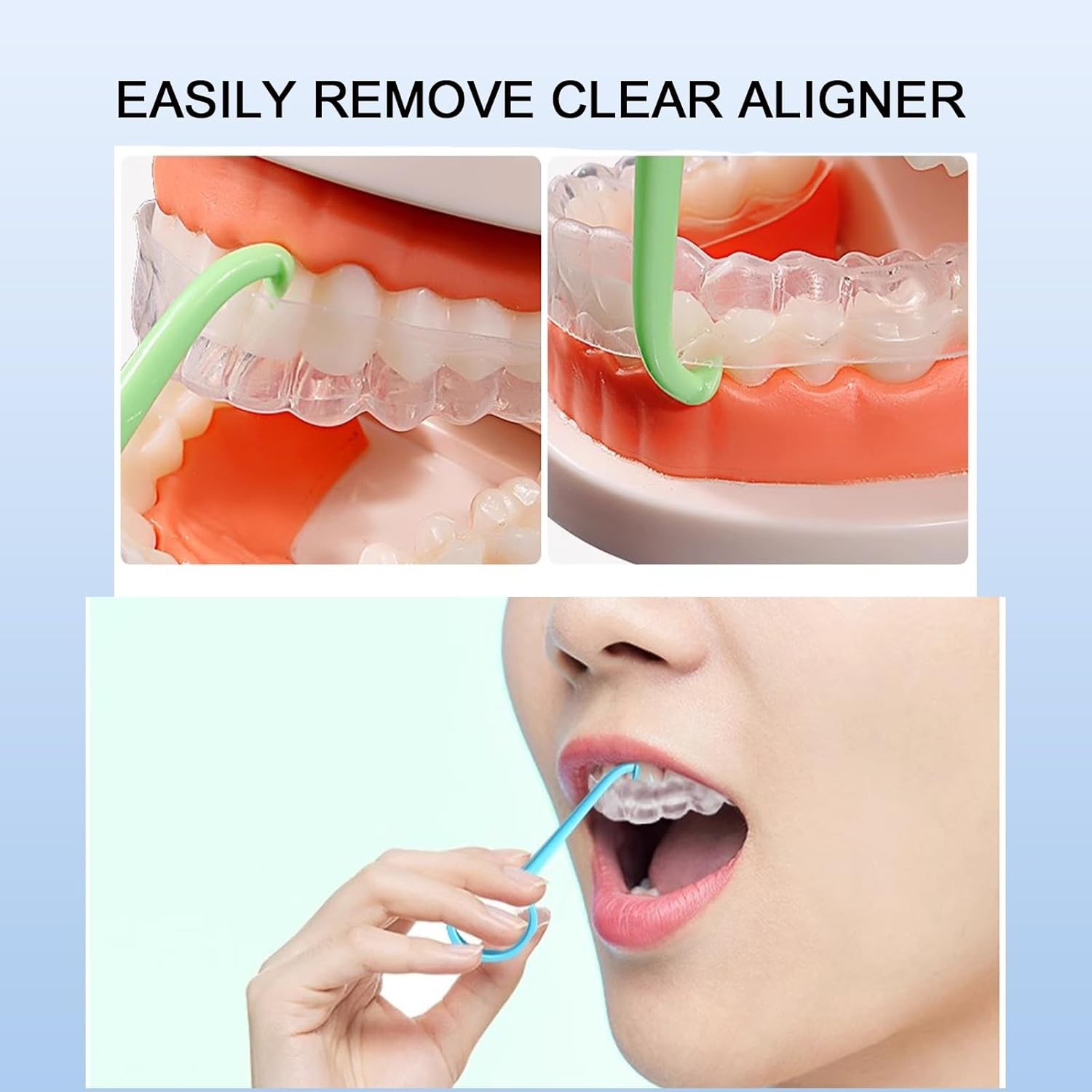 5PCS Aligner Removal Tool,5 Colors Clear RemoverTools 5pcs Mix