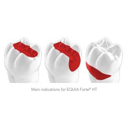 GC EQUIA Forte HT Capsule Bulk Fill Glass Hybrid Restorative Dental 50pcs