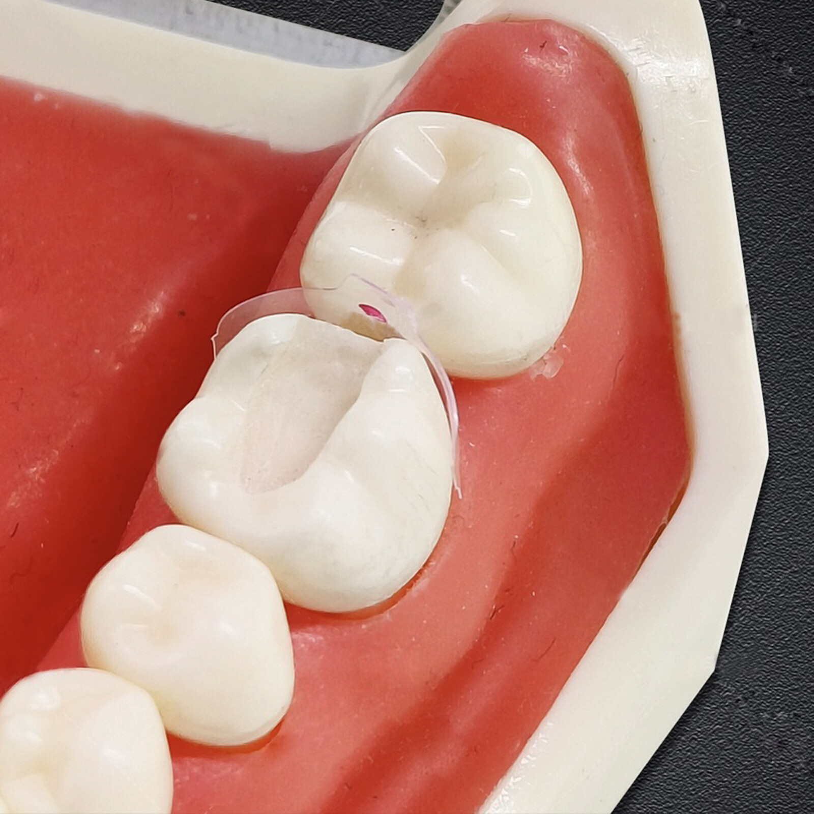 Clear Matrix Dental Anterior Posterior Transparent BT Matrices Fit BioClear