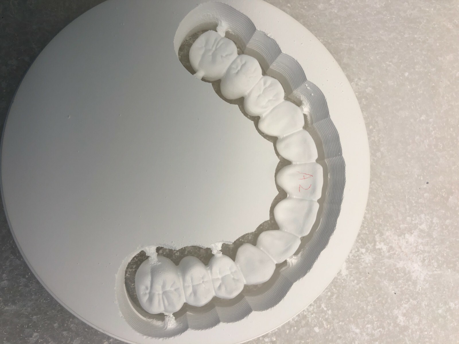 Crown & Bridge & Implant abutment Design Service & Digital CAD/CAM 