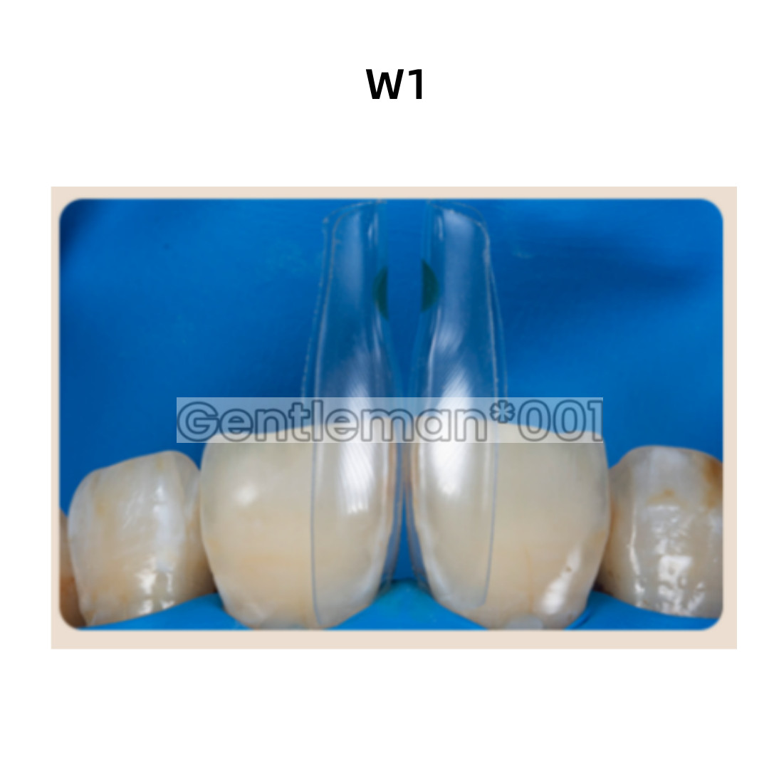 SIGNET Dental Widening Front Tranparent Clear Matrix BT Matrices Fits BioClear