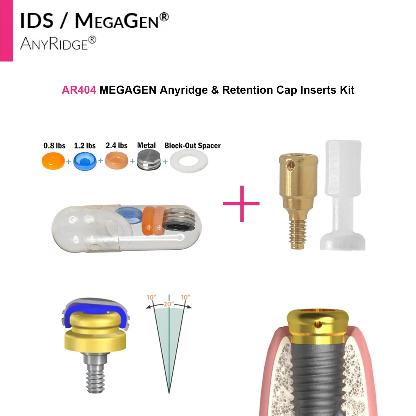 Zest Locator Overdenture Abutment Anchor For MEGAGEN AnyRidge AR Retention Caps