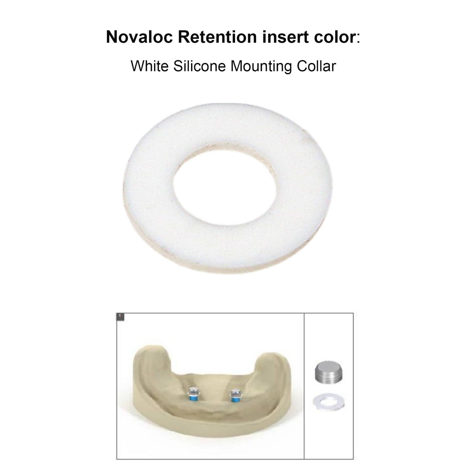 Implant Retention Inserts for Novaloc Overdenture Titanium Housing Kit PEEK Caps