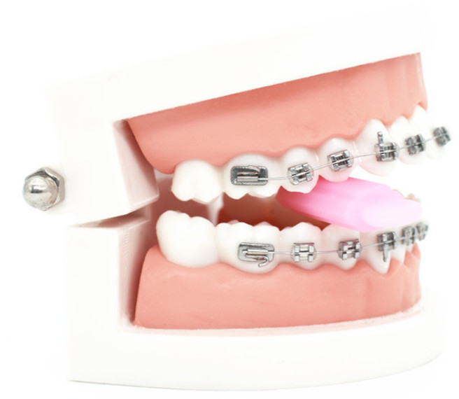 Dental Aligner Chewies Mouth Tray Seaters Ortho 5-Flavor 3-Hardness