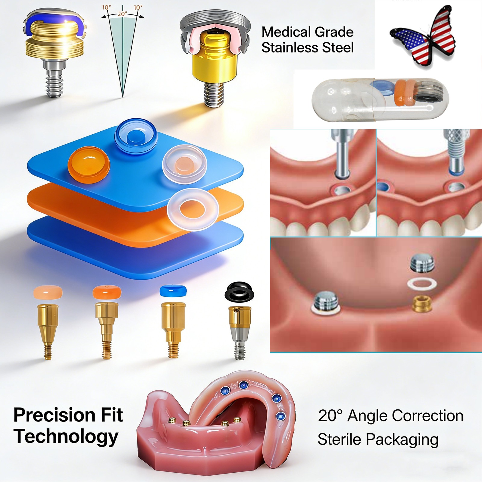 US Zest Attachment Locator Abutment Internal Conical Connection for NobelActive