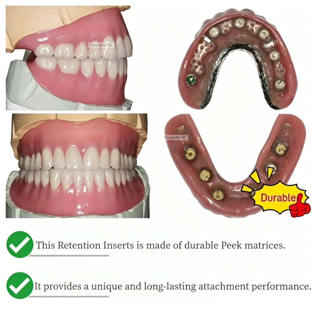 Dental Novaloc Retention Inserts Caps Peek Locator Mounting & Demounting Tool