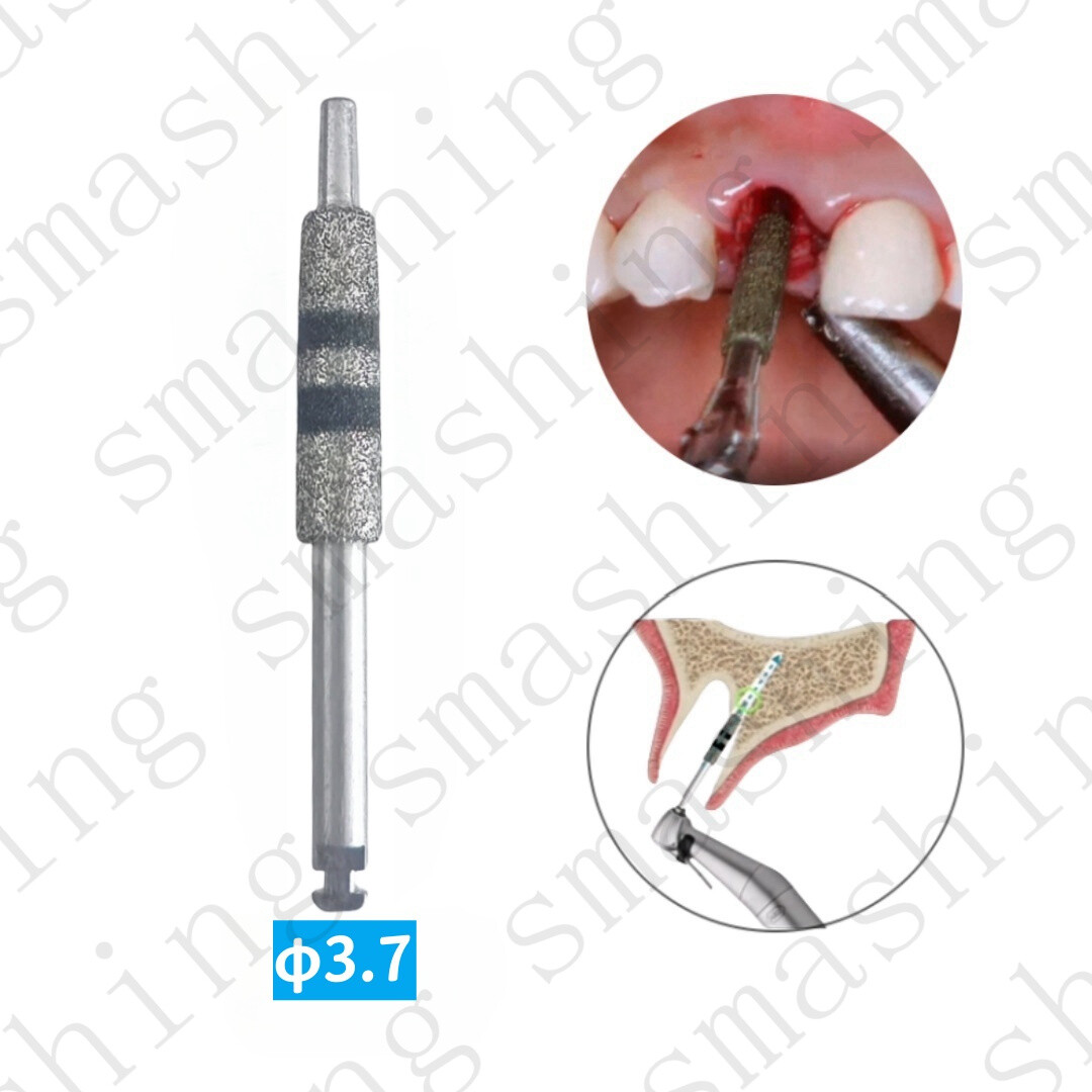 3.7 Dental Im plant Guided Neck Correction Drill FG7604 Diamond Grinding Jawbone