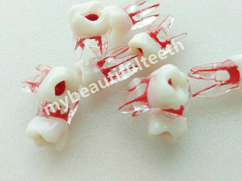 Dental Molar Endo Master Root Canal Study Model RCT Practice Block Pulp Cavity