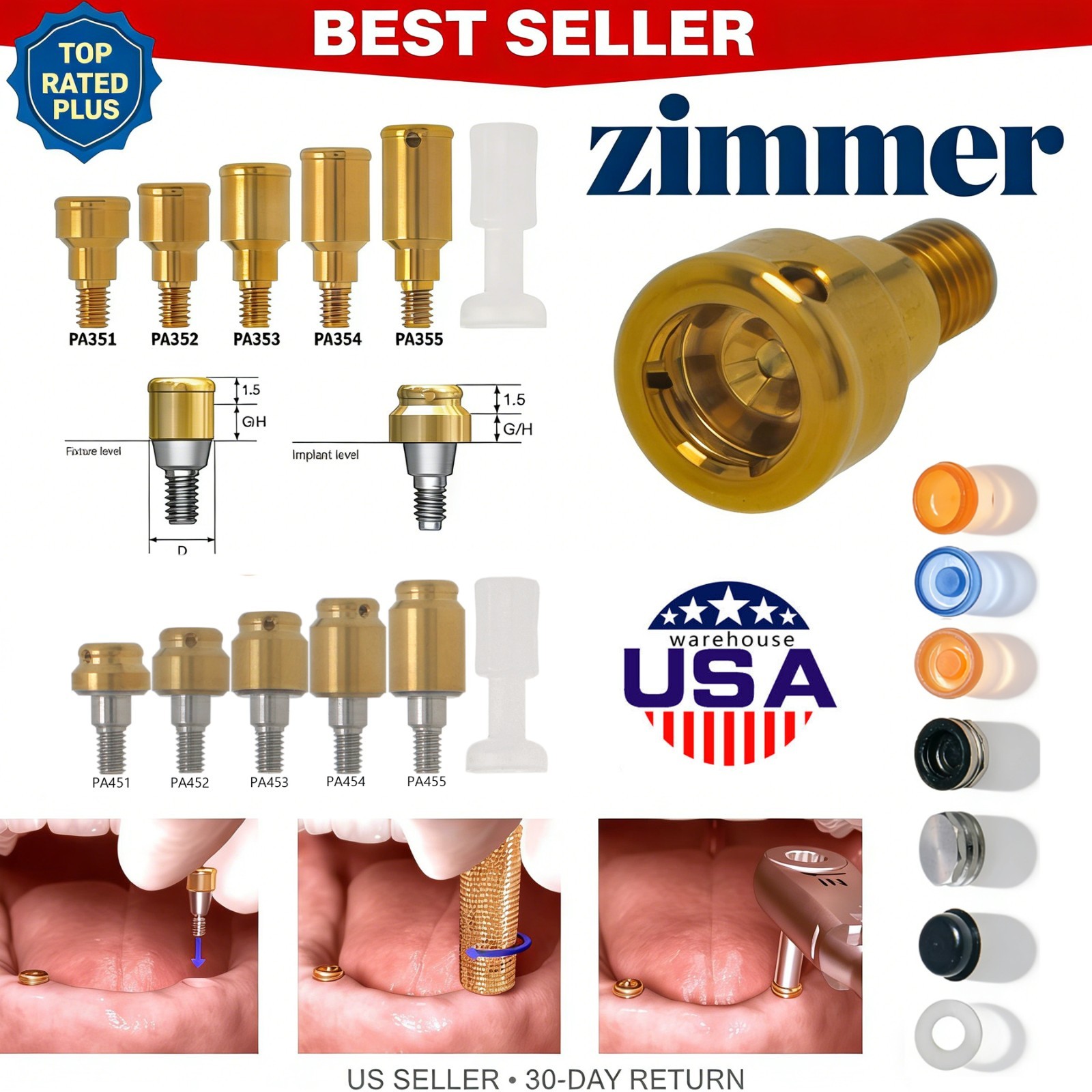 US Locator Overdenture Abutment Fit Zimmer Tapered TSV 3.5/4.5mm BEGO MIS Cortex