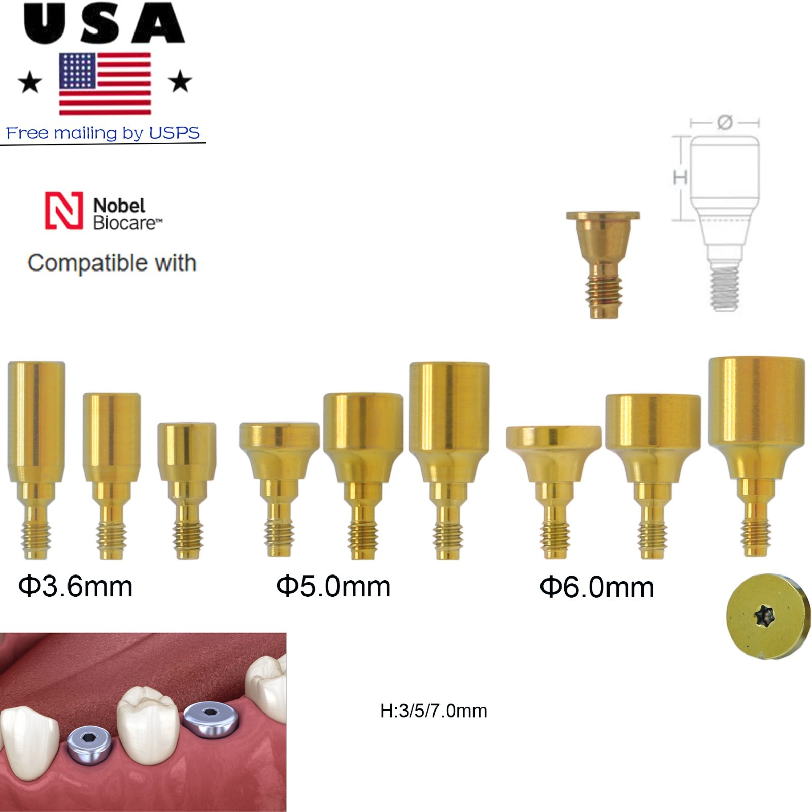 US Dental Healing Abutment NP RP ∅3.6/5.0/6.0 for Nobel Active Conical Titanium