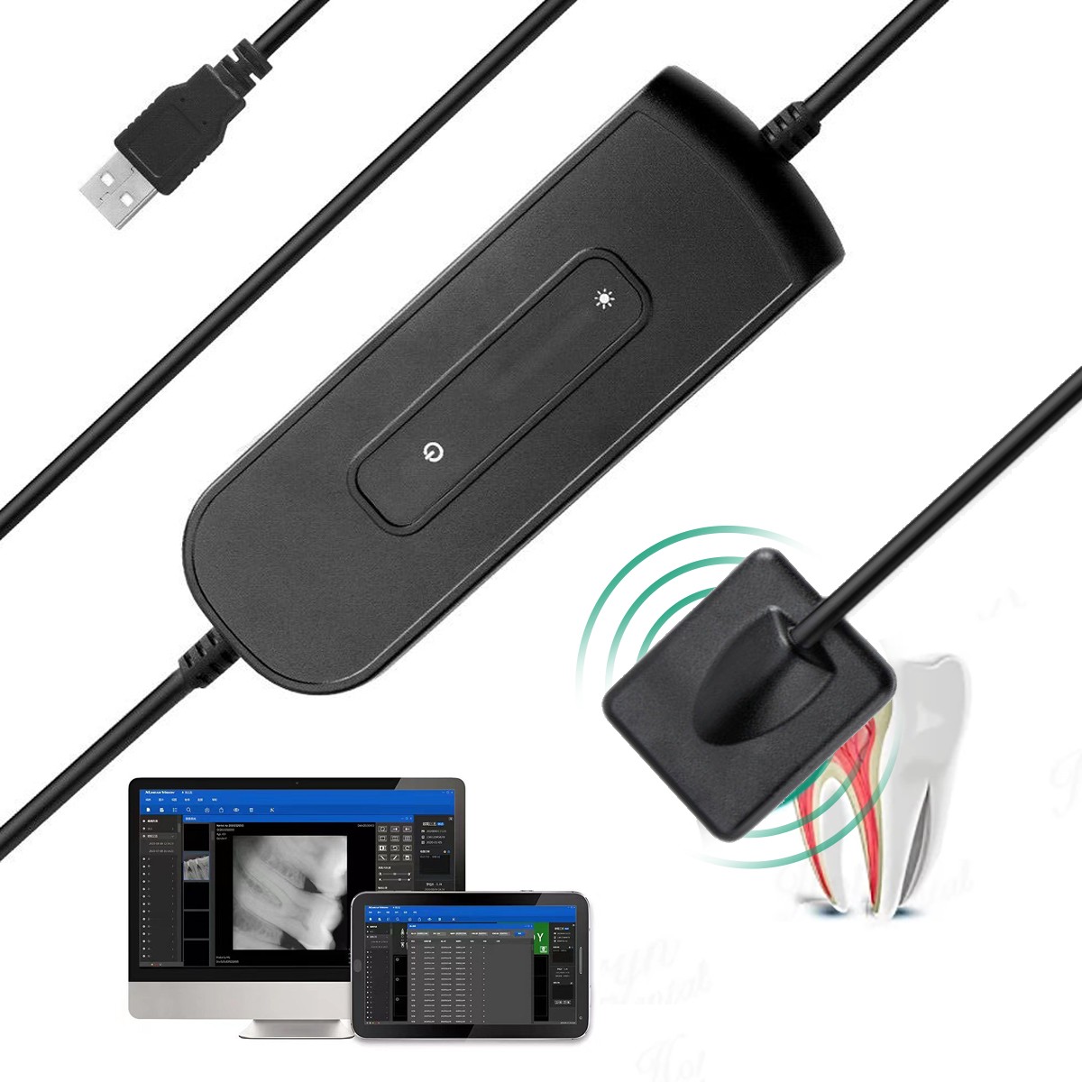 Sensor r2 Dental Intraoral Digital Sensor Size R2