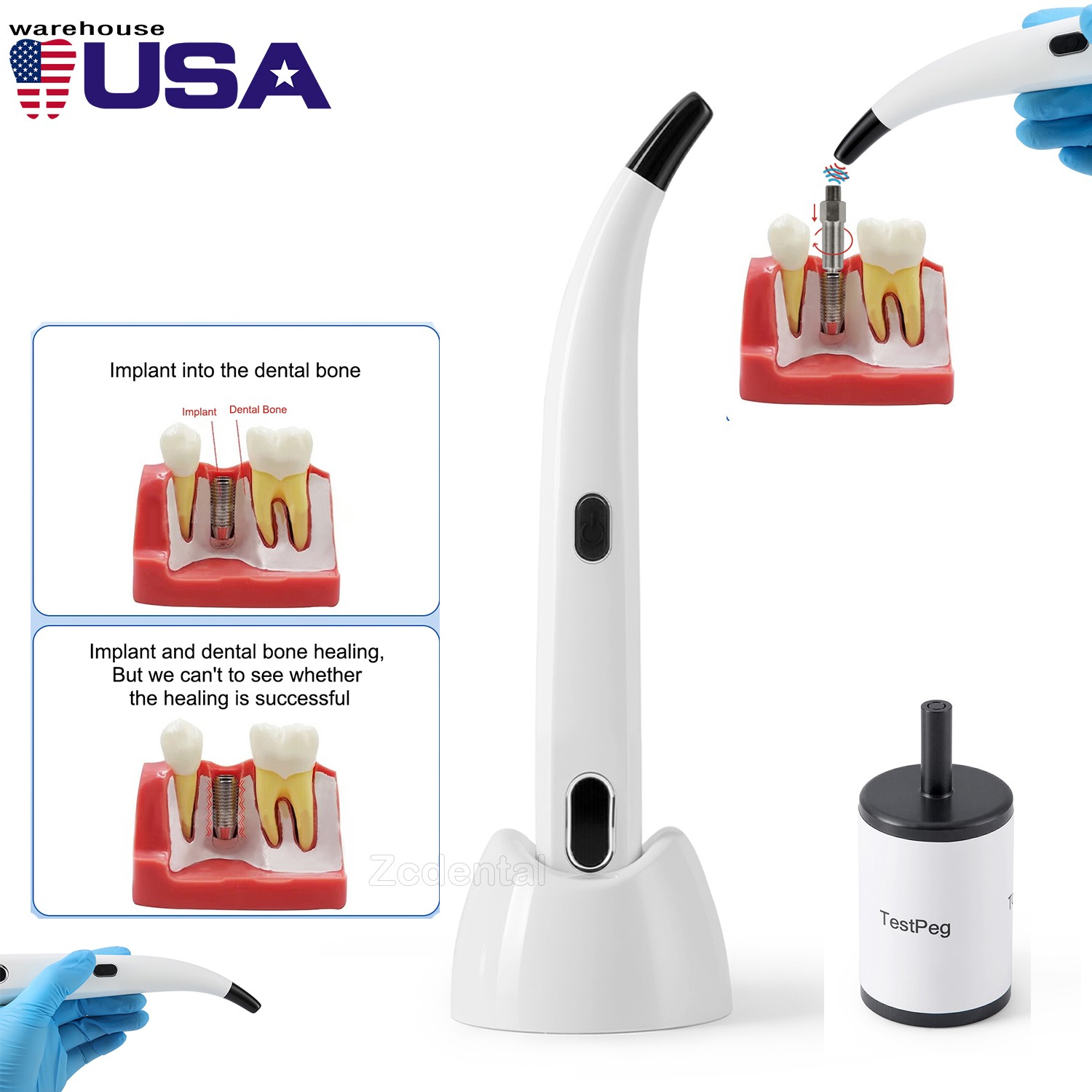 Handheld Dental Osstell Beacon Isq Implant Stability Meter Tool Instrument