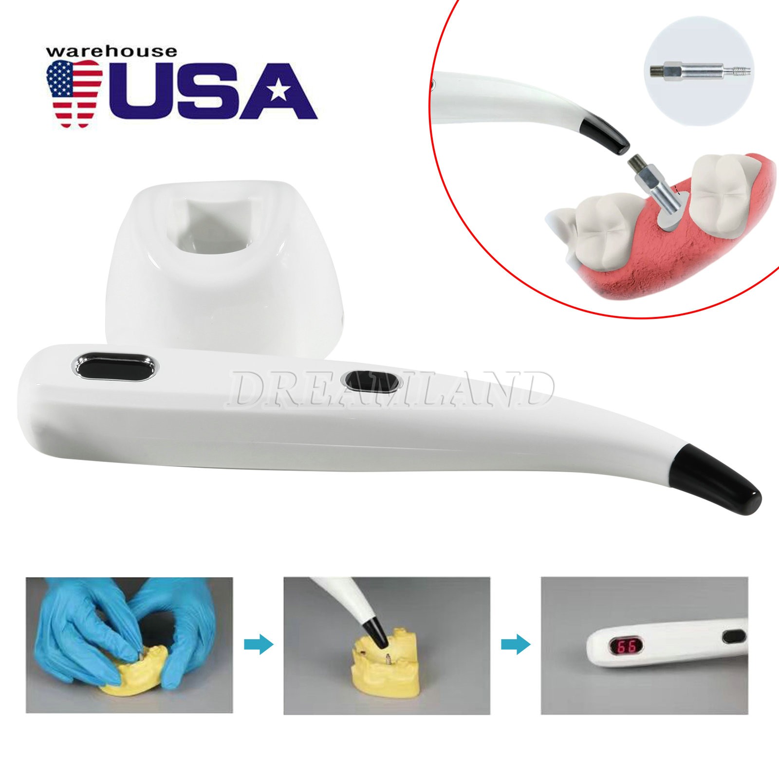 Dental Implant Osseointegration Implant Stability Measurement Monitor Tester
