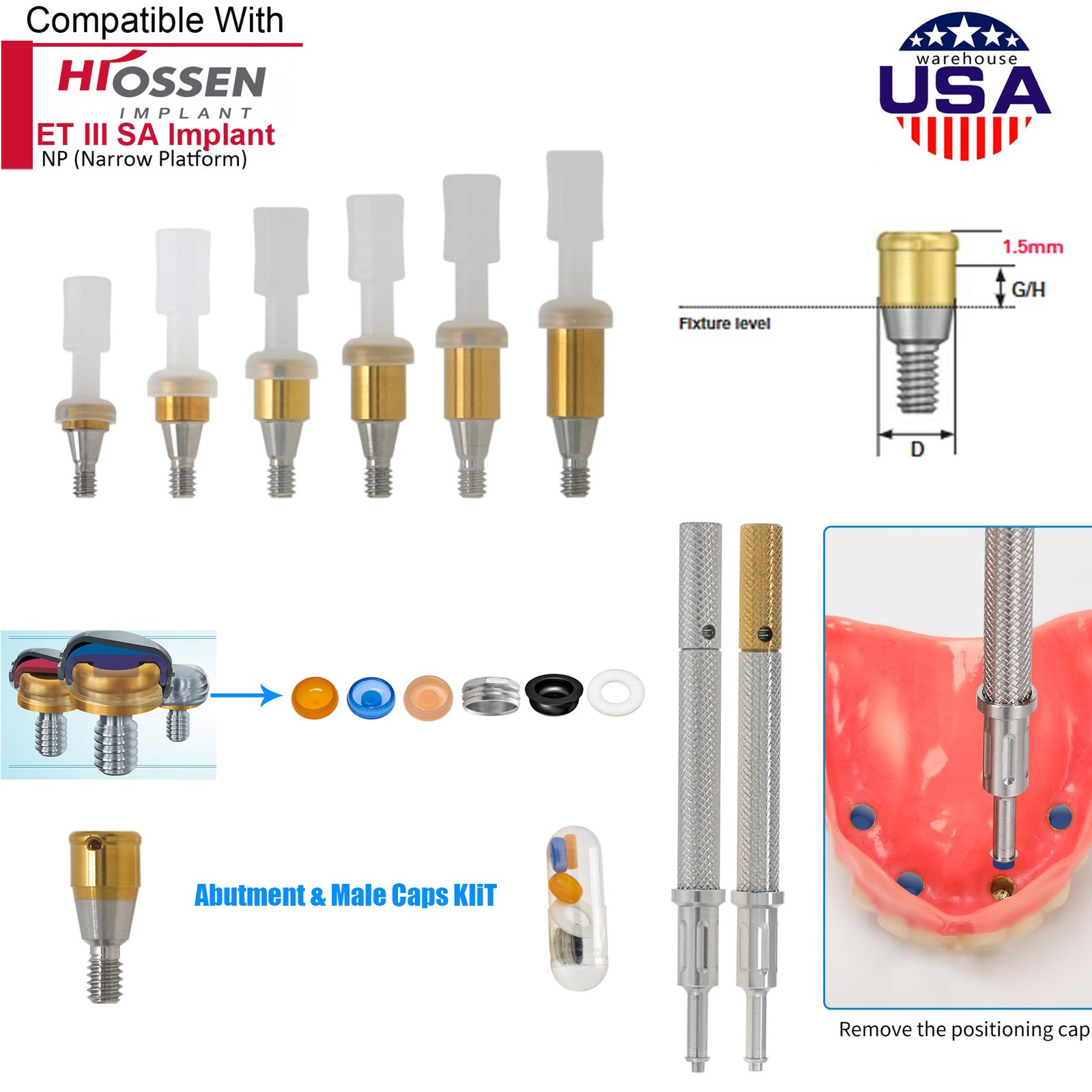 US Locator Tapered Overdenture Abutment Fit Hiossen/NobelActive /Zimmer/Adin/MIS