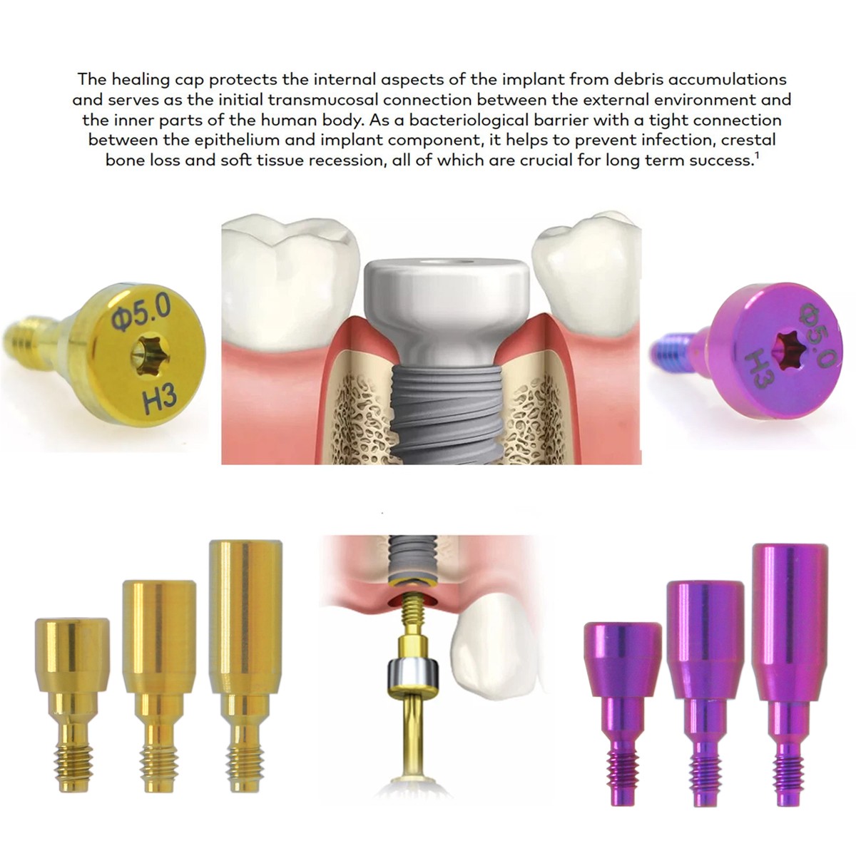 US Nobel Biocare Titanium Healing Abutment NP RP Internal Conical ∅3.6/5.0/6.0mm