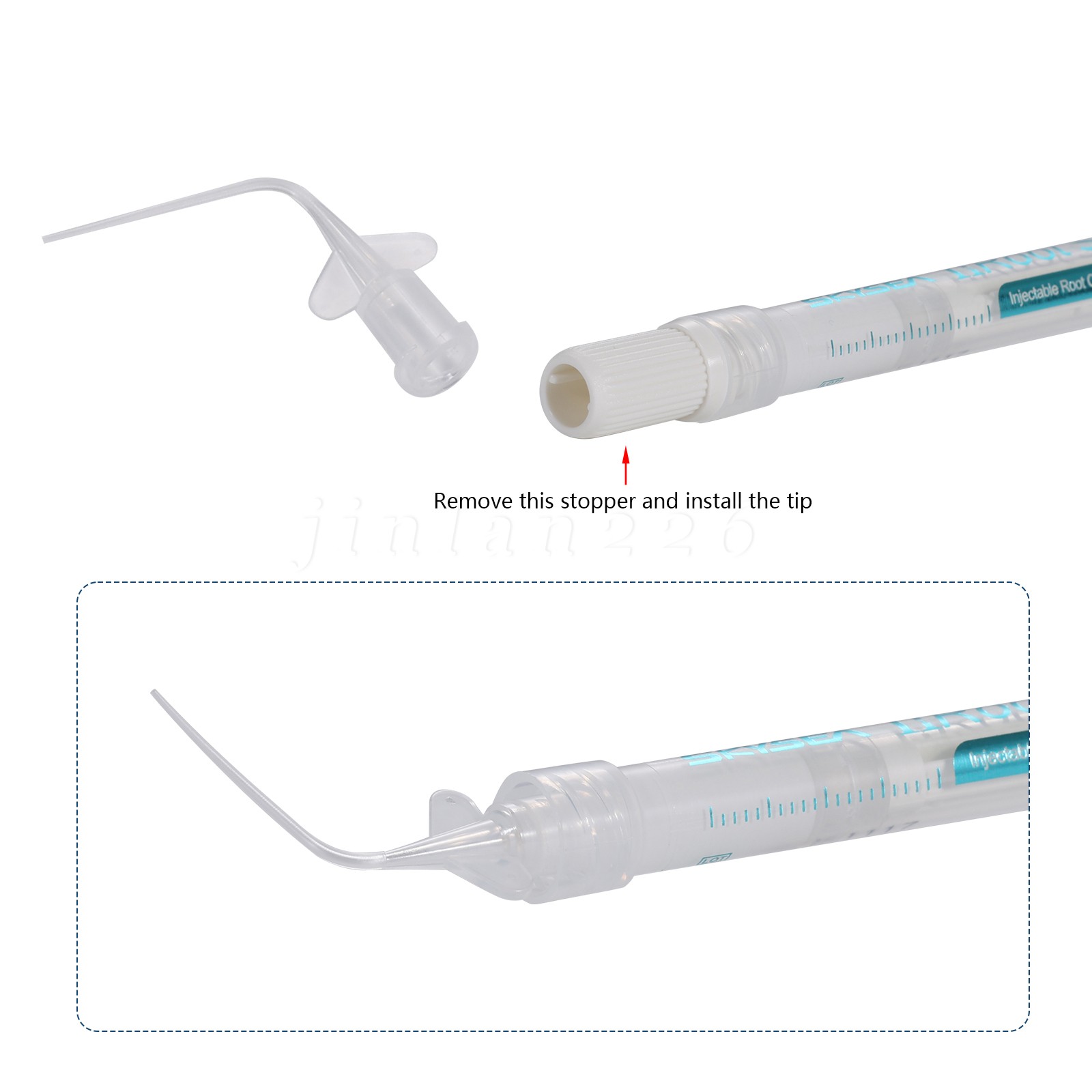 1g nRoot SP Ready to Use BioCeramic Sealer for Root Obturation+10 Tips
