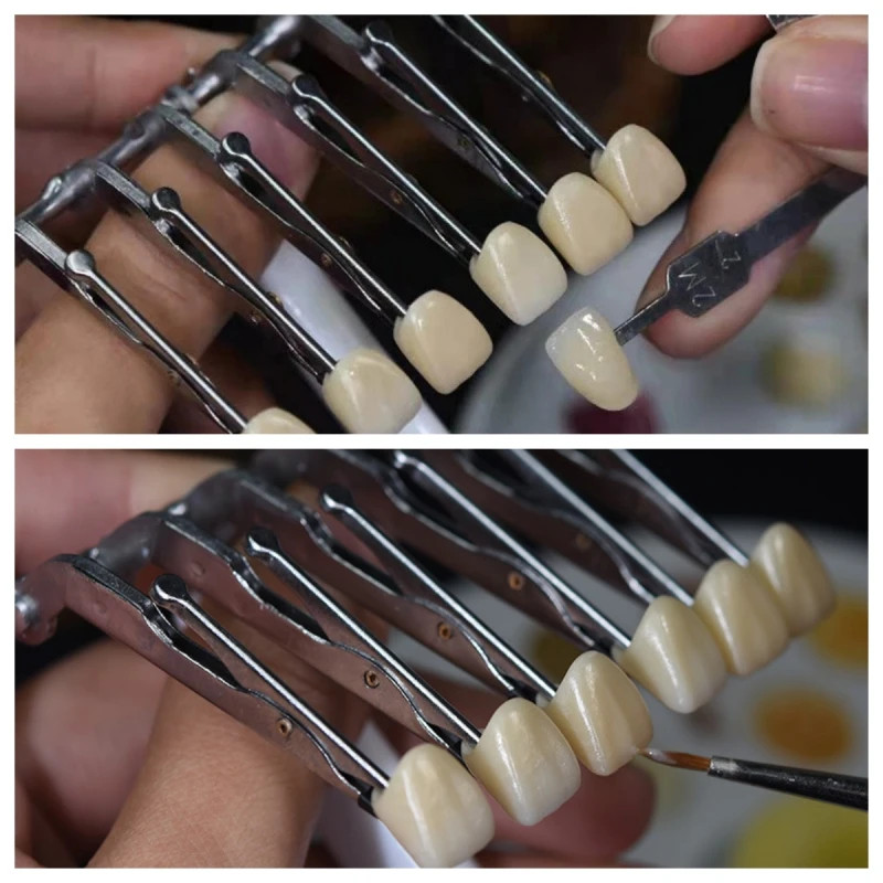 Dental Veneer Glazing Clip Crown Porcelain Teeth Veneer Glaze Holder Clamp