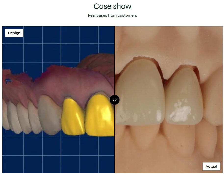 Dental Lithium Disilicate CAD CAM Glass Ceramic Blocks MT Translucency A1–BL4