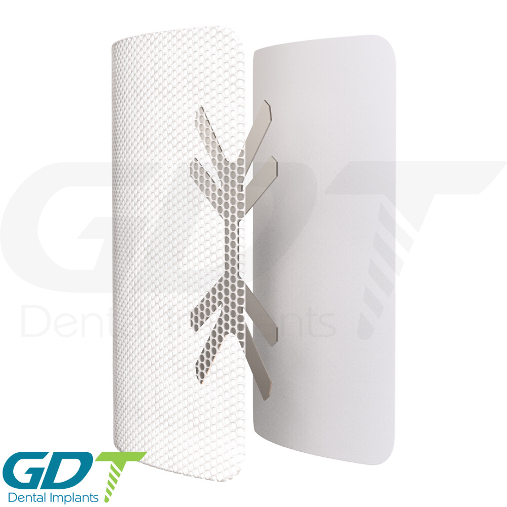Titanium Reinforced PTFE Membrane Barrier 25mmX30mm Sterile Dental GBR Synthetic