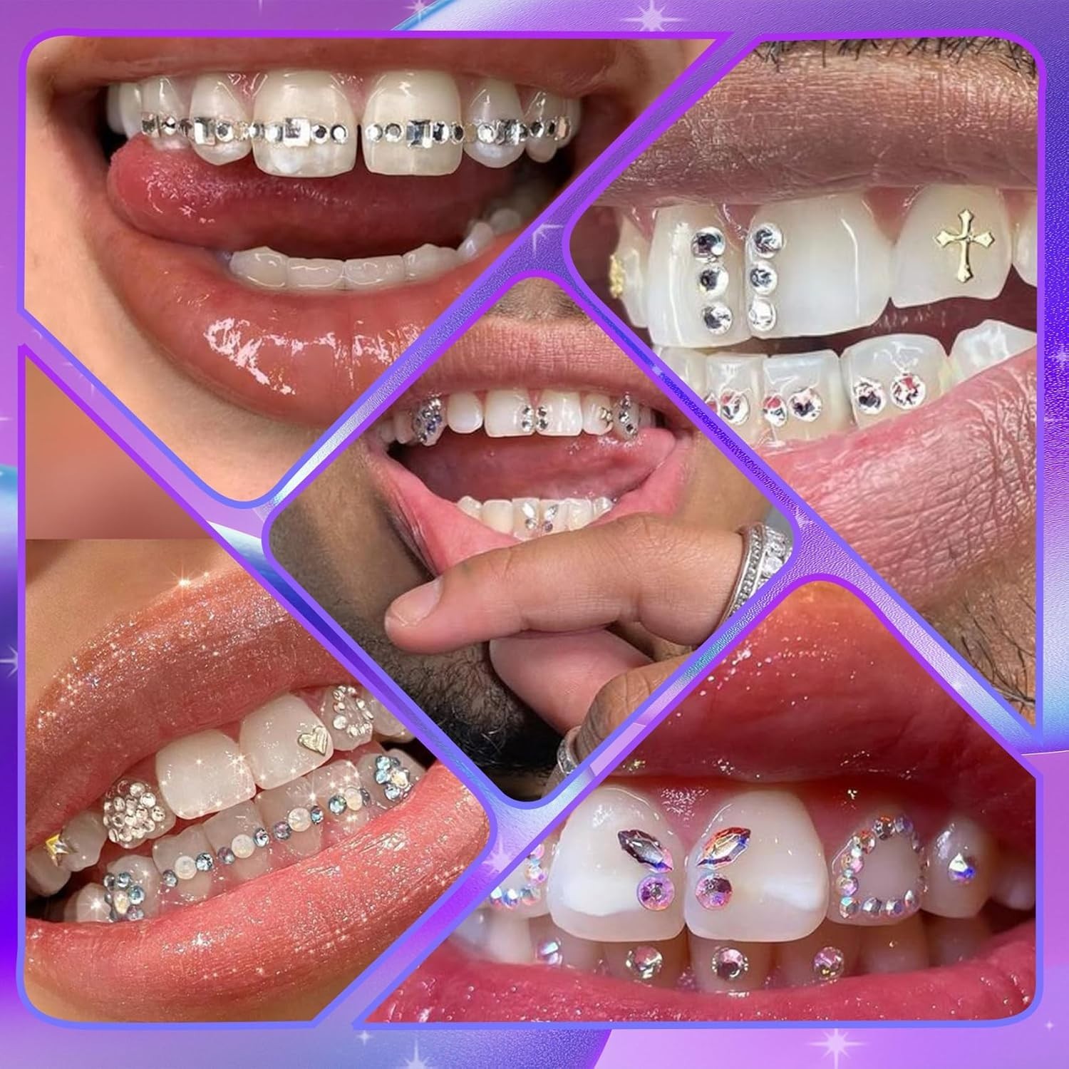 Professional Tooth Gem Starter Set – 22 Shapes, 3 Colors for Unique Smiles