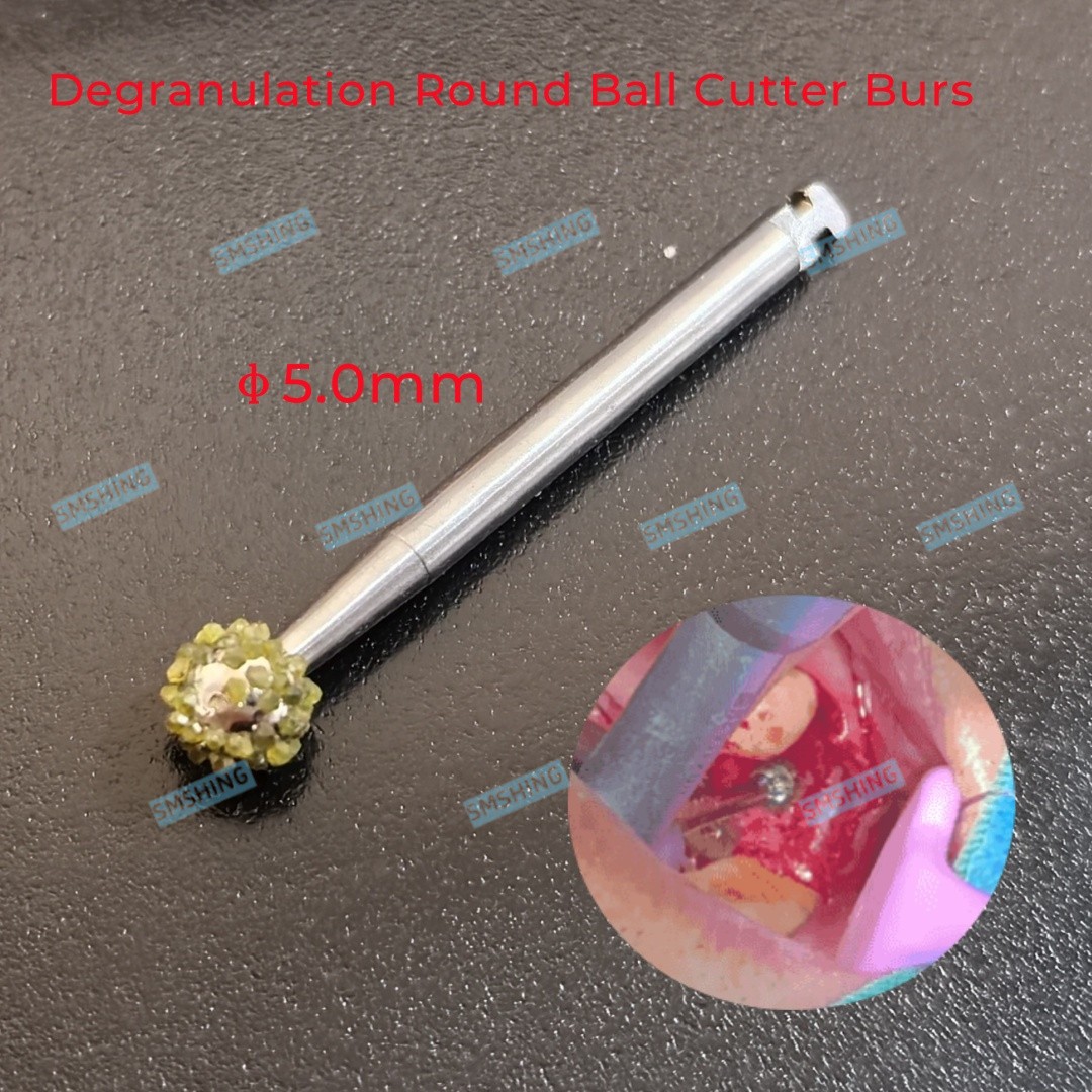 5.0mm Degranulation Ball Cutter Burs Remove Tissue Bon Debridement Tear Tissues