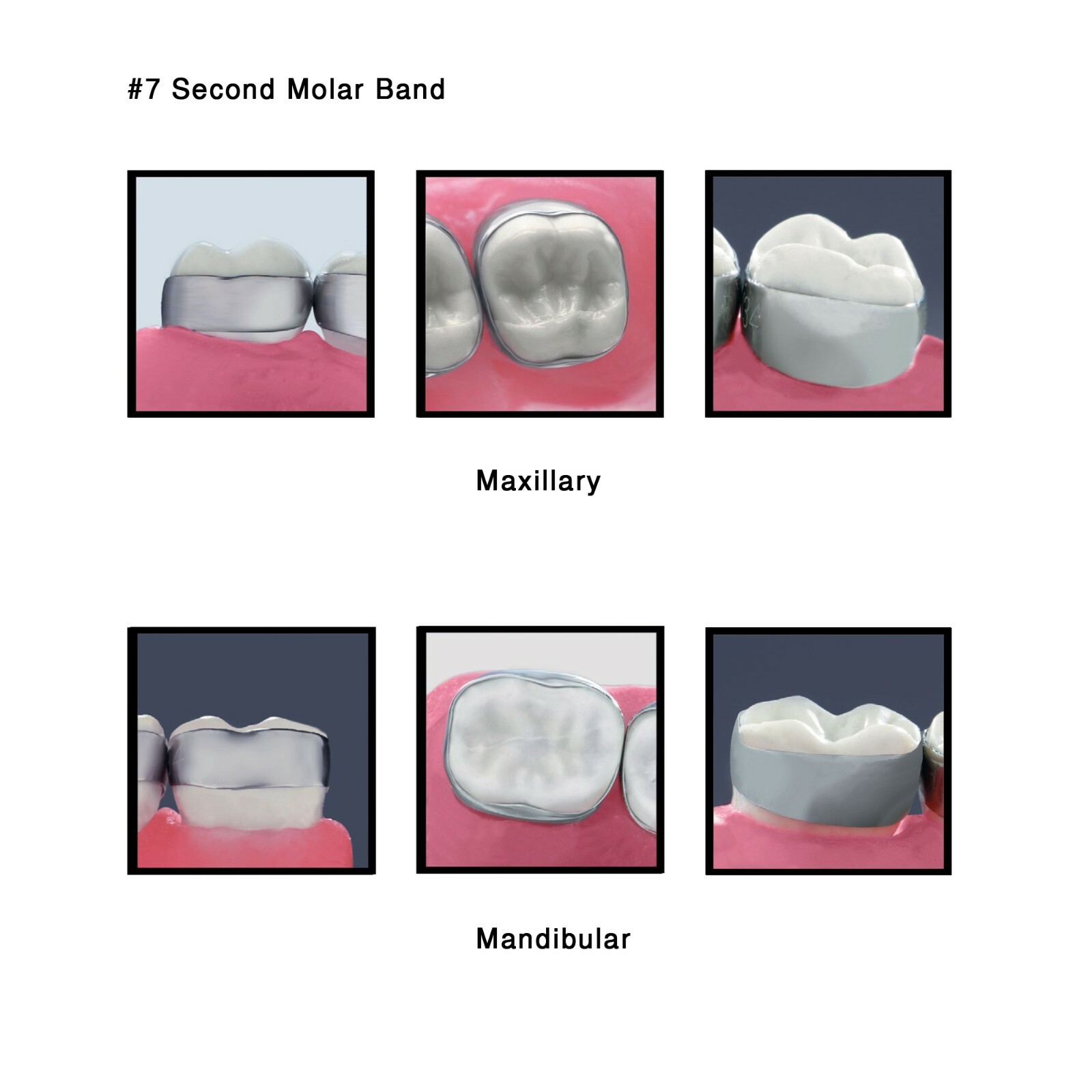 J&J Ortho™ Orthodontic #7 Second Molar Band Quadrant (4/pk) Optional Size