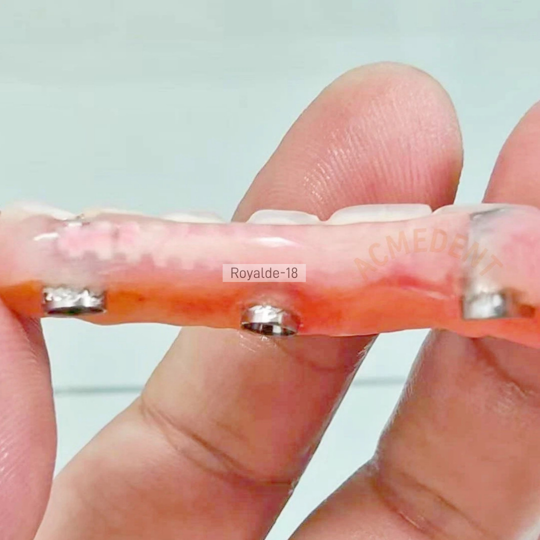 Dental Implan Connector Stainless Tianium Strengthener Wire Overdenture MU Wire