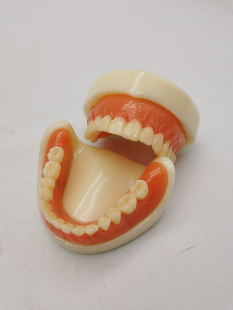 Dental 4 Implants Overdenture Typodont Restoration Upper Lower Lower Teeth Model