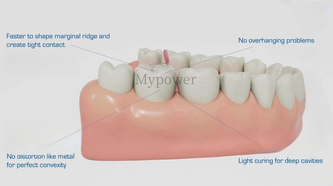 Dental Clear Matrix Anterior Posterior Teeth Matrix Wedges Kit Fit Bioclear BT