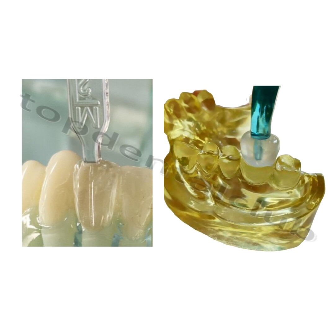 Dental Aesthetic Printing Restoration Filling Tool Anterior Posterior Teeth